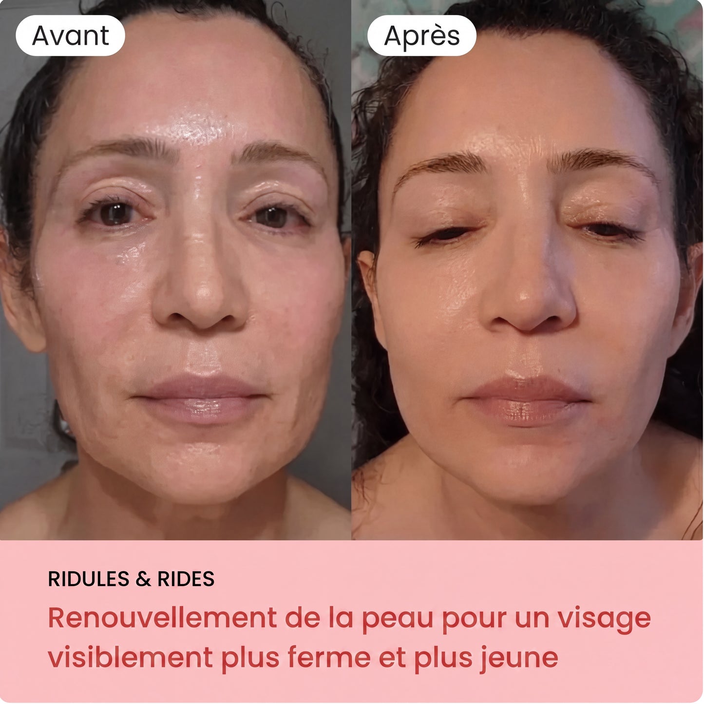 Bâton de collagène