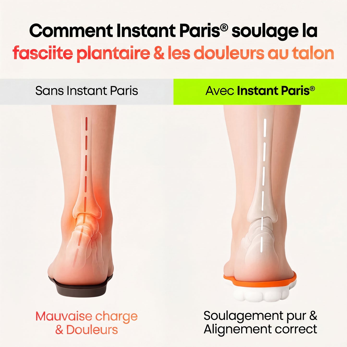 Instant Paris - Semelles de Soulagement